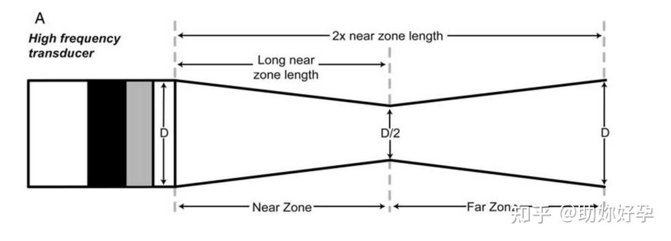 超声成像中的分辨率